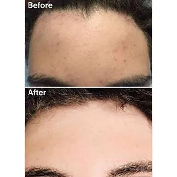 Teenology Gentle Face Cleanser for Clear Skin and Freshness