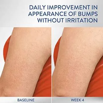 CETAPHIL Daily Smoothing Moisturizer for Sensitive Skin