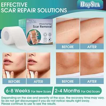 Reusable Silicone Scar Sheets for Effective Treatment