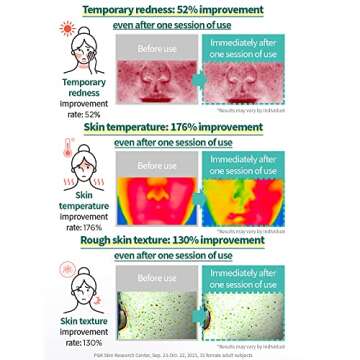 AESTURA A-CICA365 Blemish Calming Face Serum, Niacinamide Serum for Dry and Sensitive Skin, Redness Relief for Acne, Minimize Blemishes, 1.35 Fl Oz (40ml)