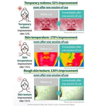 AESTURA A-CICA365 Blemish Calming Face Serum, Niacinamide Serum for Dry and Sensitive Skin, Redness Relief for Acne, Minimize Blemishes, 1.35 Fl Oz (40ml)