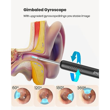 BEBIRD R1 Wax Removal Tool 1080P HD Camera Ear Cleaner