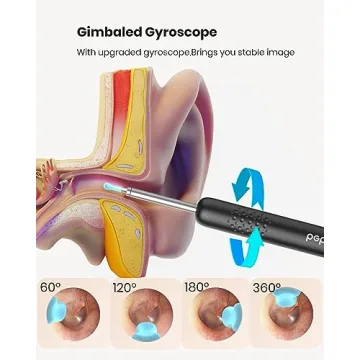 BEBIRD R1 Wax Removal Tool 1080P HD Camera Ear Cleaner