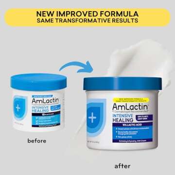 AmLactin Intensive Healing Body Cream, 12 oz Tub, 2-in-1 Exfoliator and Moisturizer for Dry Skin with 15% Lactic Acid and Ceramides for 24-Hour Moisturization