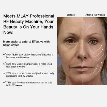 MLAY Radio Frequency Skin Tightening Machine