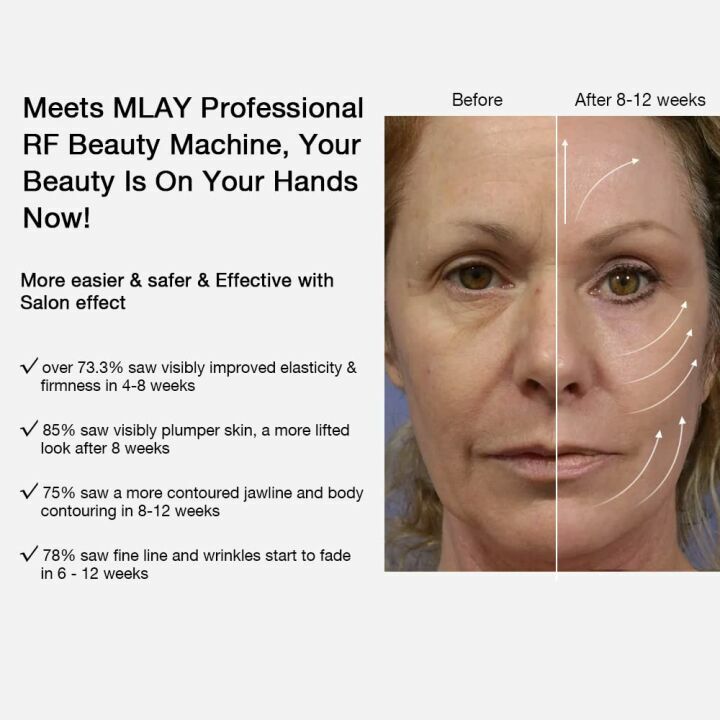MLAY Radio Frequency Skin Tightening Machine