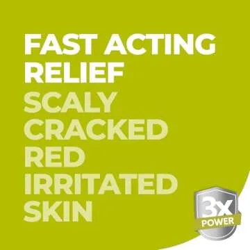 terrasil Ringworm Treatment for Humans – Antifungal Ringworm Cream for Adults & Kids, Clinically Proven 1% Clotrimazole Cream, Treats Most Ringworm Infections, Soothing Relief of Itchy Skin (0.5oz)