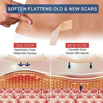 Silicone Scar Sheets Roll - Effective Scar Management