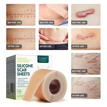 Silicone Scar Sheets Roll - Effective Scar Management
