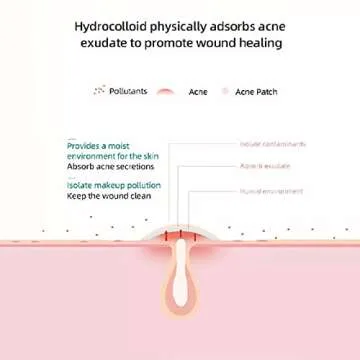 Effective Emenet Acne Pimple Patches for Clear Skin