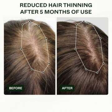 Scandinavian Biolabs Hair Activation Routine for Women - Clinically Tested with Results in 45 Days -...