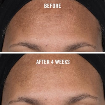 First Aid Beauty Niacinamide Dark Spot Serum for Radiant Skin