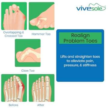 ViveSole Budin Splint Toe Straightener for Comfort and Relief