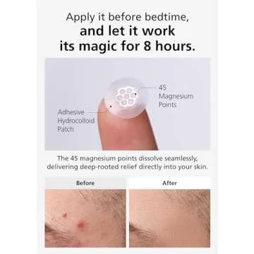 DWEasyDerm Quick Calming Magnesium Patches for Clear Skin