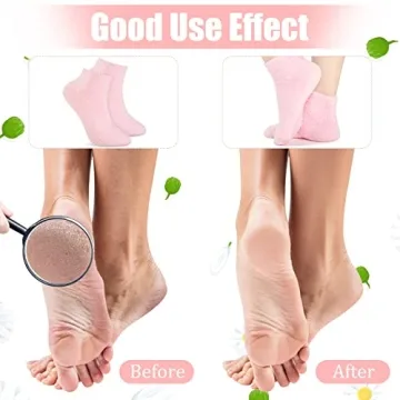 Janmercy Aloe Socks - 3 Pairs of Moisturizing Cozy Socks
