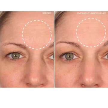 SiO Beauty BrowLift Forehead Anti-Wrinkle Patch - Rapid Overnight Reusable Silicone Patch to Reduce Furrows, Expression Lines, and Creases