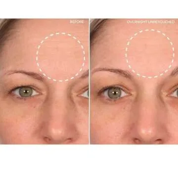 SiO Beauty BrowLift Forehead Anti-Wrinkle Patch - Rapid Overnight Reusable Silicone Patch to Reduce Furrows, Expression Lines, and Creases