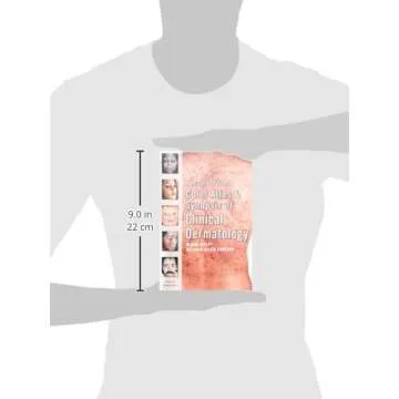 Fitzpatrick's Color Atlas and Synopsis of Clinical Dermatology: Sixth Edition
