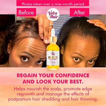 Voice of Hair PureFix Elixir for Stronger, Moisturized Hair