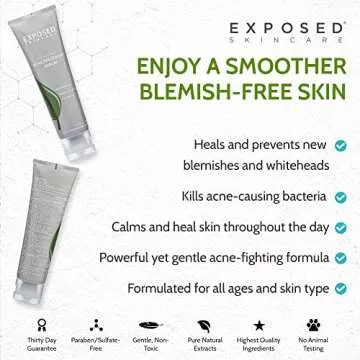 Exposed Skin Care Acne Treatment Serum Step 3 – Quickly Reduces Pimple Size and Redness - 12 Hour Spot Treatment - 3.5% Benzoyl Peroxide, Natural Green Tea & Tea Tree Oil