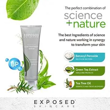 Exposed Skin Care Acne Treatment Serum Step 3 – Quickly Reduces Pimple Size and Redness - 12 Hour Spot Treatment - 3.5% Benzoyl Peroxide, Natural Green Tea & Tea Tree Oil