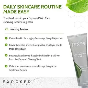 Exposed Skin Care Acne Treatment Serum Step 3 – Quickly Reduces Pimple Size and Redness - 12 Hour Spot Treatment - 3.5% Benzoyl Peroxide, Natural Green Tea & Tea Tree Oil