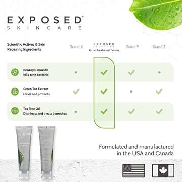 Exposed Skin Care Acne Treatment Serum Step 3 – Quickly Reduces Pimple Size and Redness - 12 Hour Spot Treatment - 3.5% Benzoyl Peroxide, Natural Green Tea & Tea Tree Oil