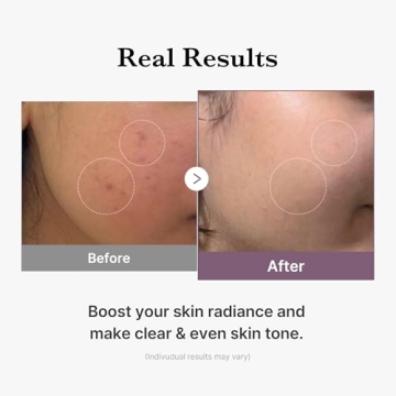 Medicube Age-R Milky Toner - Hydration & Radiance Boost