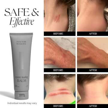 Doctor Rogers Restore Healing Balm - Ultimate Skin Care Solution for Eczema & Irritations