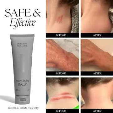 Doctor Rogers Restore Healing Balm - Ultimate Skin Care Solution for Eczema & Irritations