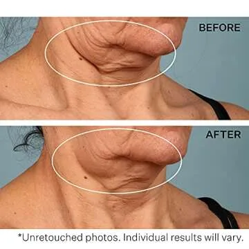 StriVectin TL Advanced Tightening Neck Cream PLUS, 1.7 Fl Oz Ã‚