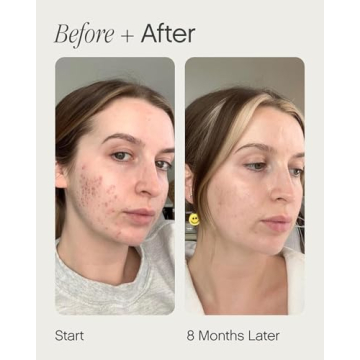 Topicals Faded Brightening and Clearing Serum for Radiant Skin