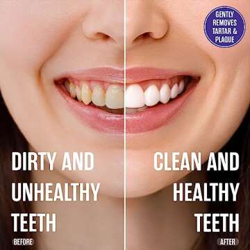 SprinJene Fluoride Free Toothpaste for Sensitive Teeth & Gum Fresh Breath Helps Dry Mouth Natural Non Fluoride Toothpaste for Adult SLS Free, Toxic Preservative Free with Black Seed Oil & Zinc 4 Pack