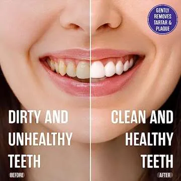 SprinJene Fluoride Free Toothpaste for Sensitive Teeth & Gum Fresh Breath Helps Dry Mouth Natural Non Fluoride Toothpaste for Adult SLS Free, Toxic Preservative Free with Black Seed Oil & Zinc 4 Pack