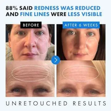 Hyaluronic Acid Face Serum - 2.5% Pure Hyaluronic Serum + 3% B5, Anti Wrinkle + Anti Aging Serum for Face with Vitamin C & E, Aloe - Antiaging Hydrating Serum, Hylunaric Acid Serum