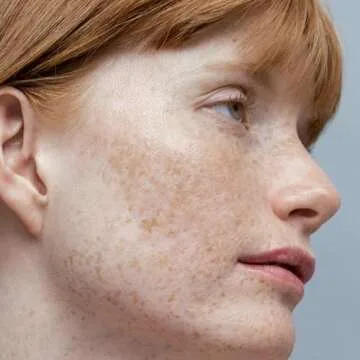 Obagi Nu-Derm Toner - Alcohol-Free & Gentle for All Skin Types