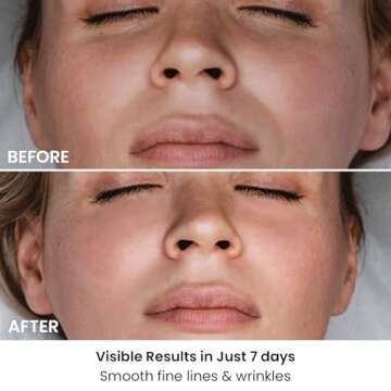 AMIRO Spectra 5-in-1 Light Therapy Mask for Glowing Skin