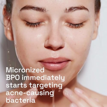 Cetaphil Gentle Clear Acne Cleanser 4.2oz