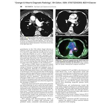 Grainger & Allison's Diagnostic Radiology 2-Volume Set