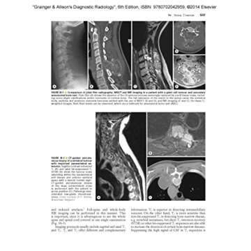 Grainger & Allison's Diagnostic Radiology 2-Volume Set