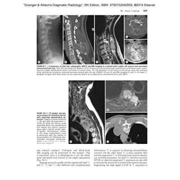 Grainger & Allison's Diagnostic Radiology 2-Volume Set