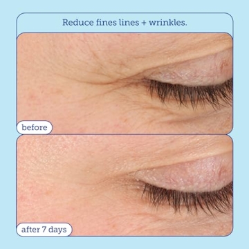 Hydrating Skinfix Eye Cream for Dark Circles and Puffiness