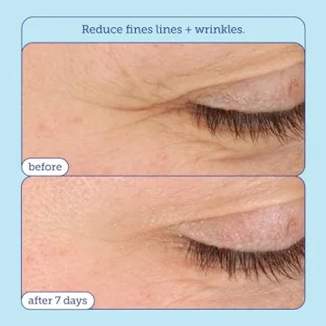 Hydrating Skinfix Eye Cream for Dark Circles and Puffiness
