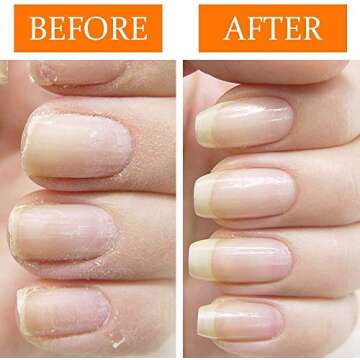 Restore Healthy Nails with Nail Tek Recovery Kit