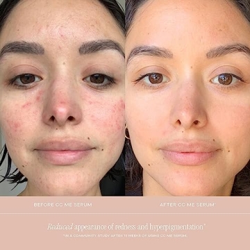 Summer Fridays CC Me Serum for Brightening and Even Skin