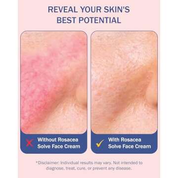 e70 Rosacea Solve Hydrating Face Wash for Women & Men - Skin Hydration & Face Redness Remover Gentle Face Cleanser with Aloe Vera, Hyaluronic Acid & Fruit Extracts, 8 fl. oz