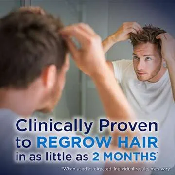 Amazon Minoxidil Foam 5% - Hair Regrowth Treatment for Men - 6-month Supply