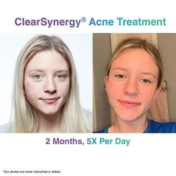 ClearSynergy One-Step Acne Treatment Foam for All Skin Types