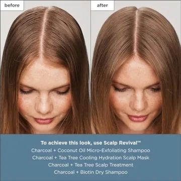 Effective Briogeo Scalp Treatment for Dry, Itchy Scalps