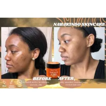 Nabak1ndo Serengeti Sunrise Face and Body Moisturizer Skincare | Ideal for Sensitive Skin and Eczema 2oz